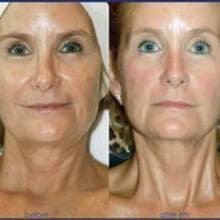 ✨ Luxe Skin Membership at Sunkissed By Sharon & Essence Of You Esthetics in Tavares, FL