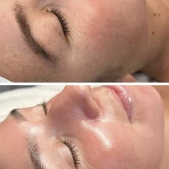 ✨ Essence Elite Skin Membership at Sunkissed By Sharon & Essence Of You Esthetics in Tavares, FL